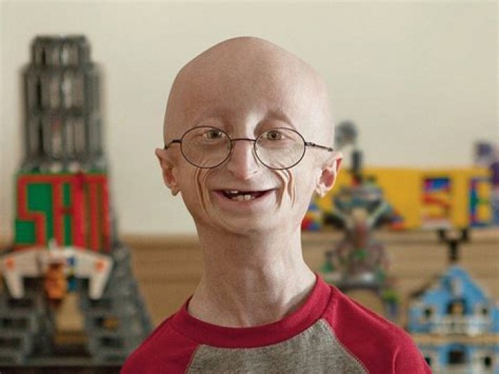 Sam Berns
